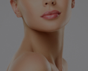 Neck Lift