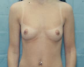 bna Image