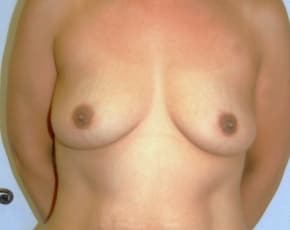 bna Image