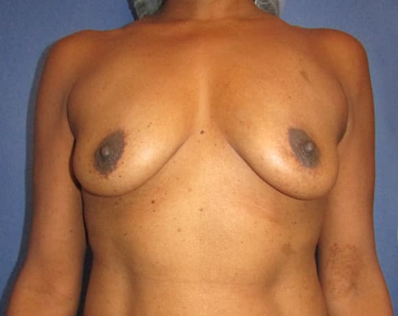 bna Image