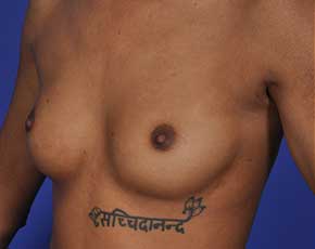 bna Image