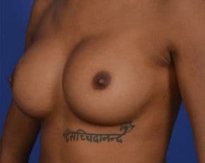 bna Image