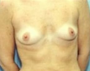 bna Image