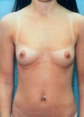 bna Image