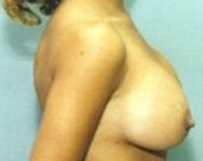 bna Image