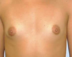 bna Image