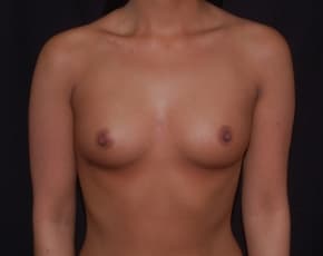 bna Image