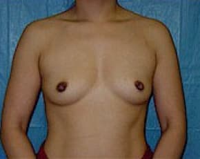 bna Image
