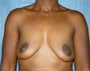 bna Image