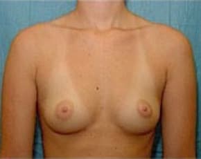 bna Image