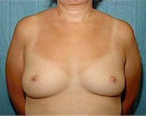bna Image
