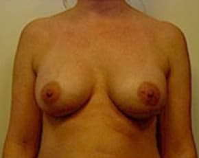 bna Image