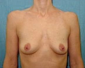 bna Image