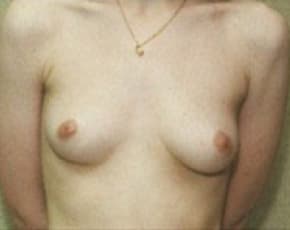 bna Image