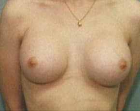 bna Image