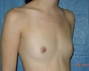 bna Image