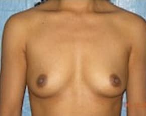 bna Image