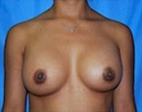 bna Image