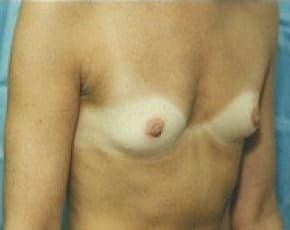 bna Image