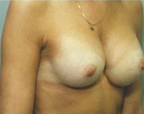 bna Image