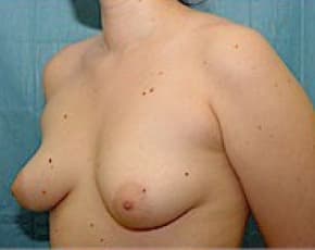 bna Image
