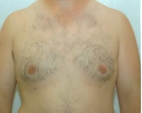 bna Image