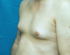 bna Image