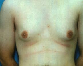 bna Image