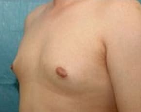 bna Image