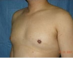 bna Image