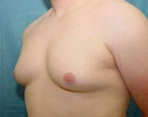 bna Image