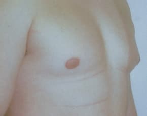bna Image