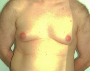bna Image
