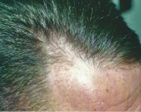    Before & After Photos | Associates in Plastic Surgery