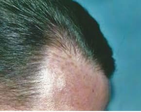    Before & After Photos | Associates in Plastic Surgery