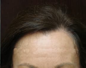    Before & After Photos | Associates in Plastic Surgery