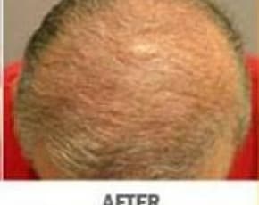    Before & After Photos | Associates in Plastic Surgery