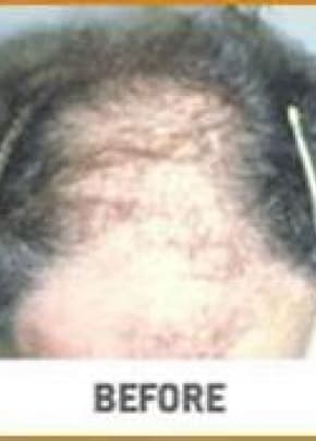    Before & After Photos | Associates in Plastic Surgery