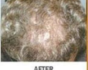    Before & After Photos | Associates in Plastic Surgery