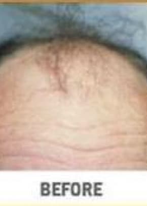    Before & After Photos | Associates in Plastic Surgery