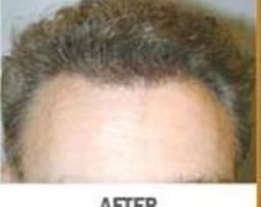   Before & After Photos | Associates in Plastic Surgery
