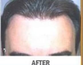    Before & After Photos | Associates in Plastic Surgery