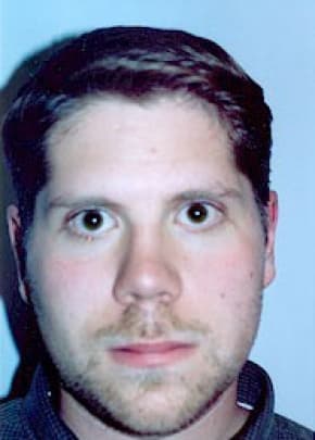 Otoplasty Before & After Photos | Associates in Plastic Surgery